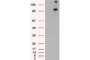 Western Blotting (WB) image for anti-Tuberous Sclerosis 1 (TSC1) antibody (ABIN5868148) (TSC1 抗体)