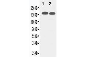Anti-TJP2 antibody, Western blotting Lane 1: 293T Cell Lysate Lane 2: MCF-7 Cell Lysate