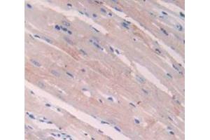 Used in DAB staining on fromalin fixed paraffin- embedded Kidney tissue (NPPA 抗体  (AA 25-152))