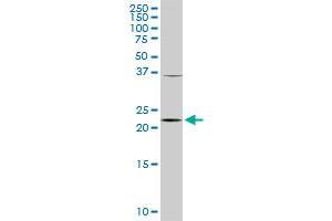 PCMT1 monoclonal antibody (M02), clone 1D6. (PCMT1 抗体  (AA 117-225))