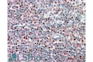 Immunohistochemistry (IHC) image for anti-Proteasome (Prosome, Macropain) Subunit, beta Type 10 (PSMB10) (Internal Region) antibody (ABIN571002)