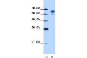 WB Suggested Anti-DDX17 Antibody Titration:  1. (DDX17 抗体  (N-Term))