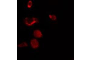 ABIN6272411 staining NIH-3T3 by IF/ICC. (RBM34 抗体  (C-Term))