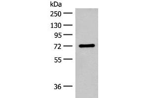 Western blot analysis of Rat brain tissue lysate using SLC6A11 Polyclonal Antibody at dilution of 1:500 (SLC6A11 抗体)
