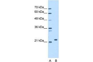 SDF2 antibody used at 1. (SDF2 抗体  (N-Term))