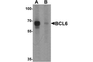 Western blot analysis of BCL6 in rat lung tissue lysate with Bcl6 Antibody  at 1 μg/ml in (A) the absence and (B) the presence of blocking peptide (BCL6 抗体  (Middle Region))