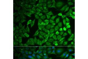 Immunofluorescence analysis of MCF-7 cells using FBXO11 Polyclonal Antibody (FBXO11 抗体)