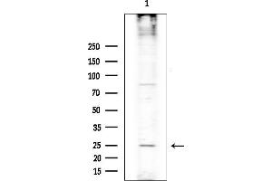 anti-RAS-Like, Family 10, Member A (RASL10A) (Internal Region) antibody