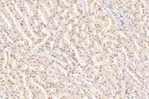 Immunohistochemistry (Paraffin-embedded Sections) (IHC (p)) image for anti-Acidic (Leucine-Rich) Nuclear phosphoprotein 32 Family, Member B (ANP32B) antibody (ABIN7072887)