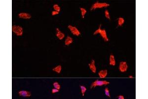 Immunofluorescence analysis of HeLa cells using ATP6V1B2 Polyclonal Antibody at dilution of 1:100. (ATP6V1B2 抗体)