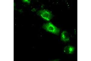 Image no. 3 for anti-Nucleotide Exchange Factor SIL1 (SIL1) antibody (ABIN1496810) (SIL1 抗体)
