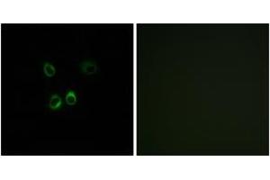 Immunofluorescence analysis of MCF7 cells, using RGR Antibody. (RGR 抗体  (AA 169-218))
