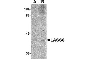Western Blotting (WB) image for anti-Ceramide Synthase 6 (CERS6) (N-Term) antibody (ABIN1031437) (CERS6 抗体  (N-Term))