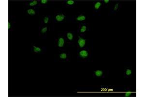 Immunofluorescence of monoclonal antibody to CSE1L on HeLa cell. (Exportin 2 抗体  (AA 872-971))