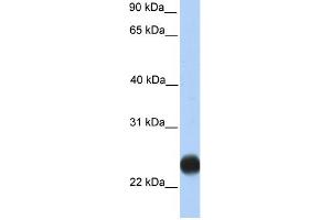 WB Suggested Anti-TMEM123 Antibody Titration:  0. (TMEM123 抗体  (C-Term))