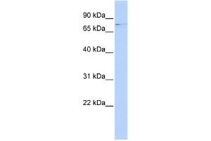 WB Suggested Anti-RRN3 Antibody Titration:  0. (RRN3 抗体  (Middle Region))