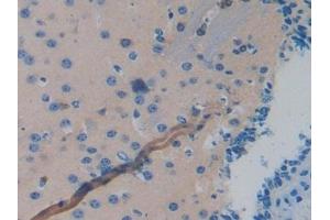 Detection of MAPT in Mouse Brain Tissue using Polyclonal Antibody to Tau Protein (MAPT) (tau 抗体  (AA 92-400))