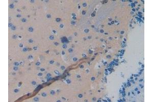 Detection of MAPT in Mouse Brain Tissue using Polyclonal Antibody to Tau Protein (MAPT) (tau 抗体  (AA 92-400))