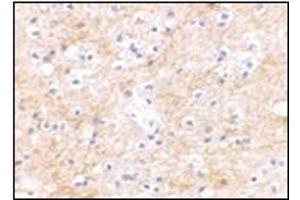 Immunohistochemical staining of human brain tissue using AP30751PU-N at 2. (DLGAP3 抗体  (C-Term))