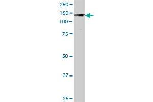 STK36 MaxPab rabbit polyclonal antibody. (STK36 抗体  (AA 1-1315))