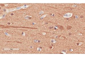 Immunohistochemical staining of human cerebral cortex tissue using anti-Beta Tubulin antibody. (Recombinant TUBB 抗体)