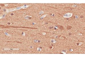 Immunohistochemistry (IHC) image for anti-Tubulin, beta (TUBB) antibody (ABIN5668109)