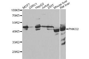 Western blot analysis of extracts of various cell lines, using PHKG2 antibody. (PHKG2 抗体)