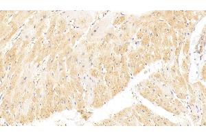 Detection of vWF in Rat Heart Tissue using Polyclonal Antibody to Von Willebrand Factor (vWF) (VWF 抗体  (AA 49-230))