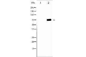 Western blot analysis of Tau phosphorylation expression in MDA-MB-435 whole cell lysates,The lane on the left is treated with the antigen-specific peptide. (MAPT 抗体  (pThr231))