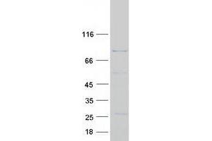 Western Blotting (WB) image for Diacylglycerol Kinase, beta 90kDa (DGKB) (Transcript Variant 1) protein (Myc-DYKDDDDK Tag) (ABIN2715545)