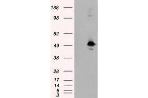 HEK293T cells were transfected with the pCMV6-ENTRY control (Left lane) or pCMV6-ENTRY KIAA1609 (Right lane) cDNA for 48 hrs and lysed. (KIAA1609 抗体)