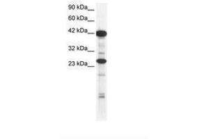 Image no. 2 for anti-SIX Homeobox 6 (SIX6) (AA 41-90) antibody (ABIN6735817) (SIX Homeobox 6 抗体  (AA 41-90))