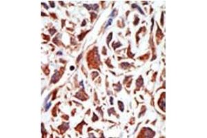 Image no. 2 for anti-BMI1 Polycomb Ring Finger Oncogene (BMI1) (C-Term) antibody (ABIN357748)