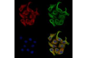 Phospho-GRK2 (Ser670) Antibody staining Hela cells(heat shock treatment) by IF/ICC. (GRK2 抗体  (pSer670))