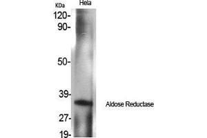 Western Blot (WB) analysis of specific cells using Aldose Reductase Polyclonal Antibody. (AKR1B1 抗体  (C-Term))