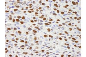 Immunohistochemistry (IHC) image for anti-Heterogeneous Nuclear Ribonucleoprotein H1 (H) (HNRNPH1) (C-Term) antibody (ABIN7448597) (HNRNPH1 抗体  (C-Term))