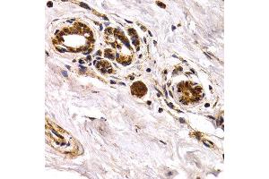 Immunohistochemistry of paraffin-embedded human normal breast using CHI3L1 antibody at dilution of 1:200 (400x lens). (CHI3L1 抗体)