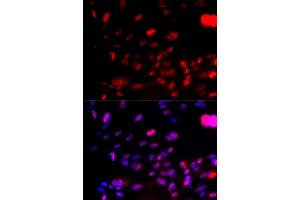 Immunofluorescence analysis of U2OS cells using Phospho-CHEK1-S317 antibody (ABIN5969879). (CHEK1 抗体  (pSer317))