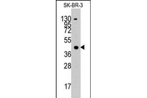 Western blot analysis of ACAT1 polyclonal antibody  in SK-BR-3 cell line lysates (35 ug/lane). (ACAT1 抗体  (C-Term))