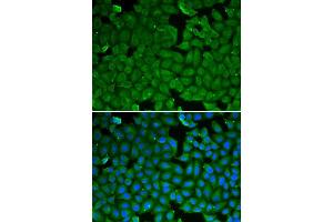 Immunofluorescence (IF) image for anti-serine Peptidase Inhibitor, Kazal Type 1 (SPINK1) (AA 24-79) antibody (ABIN6215027) (SPINK1 抗体  (AA 24-79))