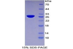 SDS-PAGE analysis of Human TFPI2 Protein. (TFPI2 蛋白)