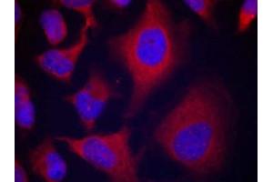 Immunofluorescence staining of methanol-fixed Hela cells using ADD1(Phospho-Ser726) Antibody. (alpha Adducin 抗体  (pSer726))