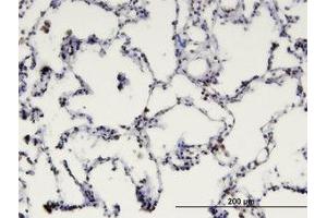 Image no. 1 for anti-Methyl-CpG Binding Domain Protein 1 (MBD1) (AA 415-509) antibody (ABIN599400) (MBD1 抗体  (AA 415-509))