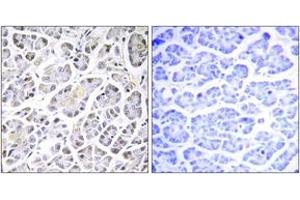 Immunohistochemistry analysis of paraffin-embedded human pancreas tissue, using ATP5G3 Antibody. (ATP5G3 抗体  (AA 1-50))