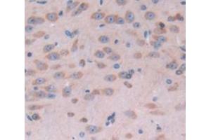 Immunohistochemistry (IHC) image for anti-Myosin Binding Protein C, Slow Type (MYBPC1) (AA 1-277) antibody (ABIN1869330)