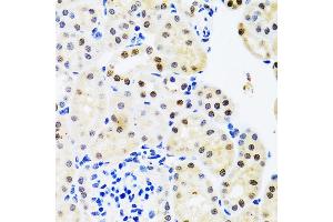 Immunohistochemistry of paraffin-embedded mouse kidney using SET/T antibody (ABIN6131353, ABIN6147631, ABIN6147634 and ABIN6221803) at dilution of 1:100 (40x lens). (SET/TAF-I 抗体  (AA 1-277))