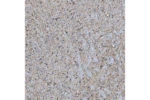 IHC analysis of SFXN5 using anti-SFXN5 antibody (ABIN7601388). (Sideroflexin 5 抗体  (AA 34-340))