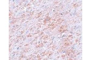 Immunohistochemistry of DLCK2 in rat brain tissue with DLCK2 antibody at 5 μg/ml. (DCLK2 抗体  (C-Term))