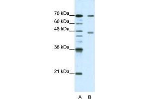 WB Suggested Anti-PABPC4 Antibody Titration:  1. (PABPC4 抗体  (N-Term))