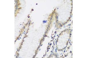 Immunohistochemistry of paraffin-embedded human stomach using NAA50 antibody. (NAA50 抗体  (AA 1-169))